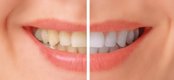 Top quality Oral Surgery in Three Rivers Michigan - Paul Blank.dental