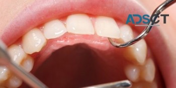 Dental Services in Three Rivers a satisfied option for the customers