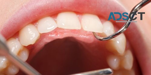 Dental Services in Three Rivers a satisfied option for the customers