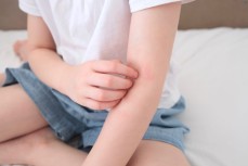 Expert Skin Allergy Treatment with AMARA in Venice, FL